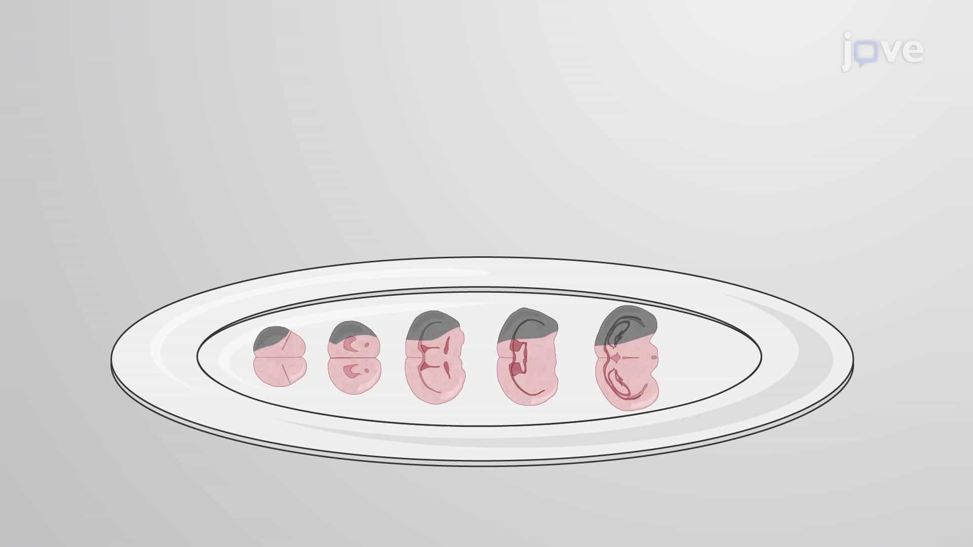 TTC Staining of Rat Brain Tissue Slices: A Staining Procedure to Differentiate Viable and Necrotic Tissue in Tissue Slices After Ischemia-Reperfusion Injury