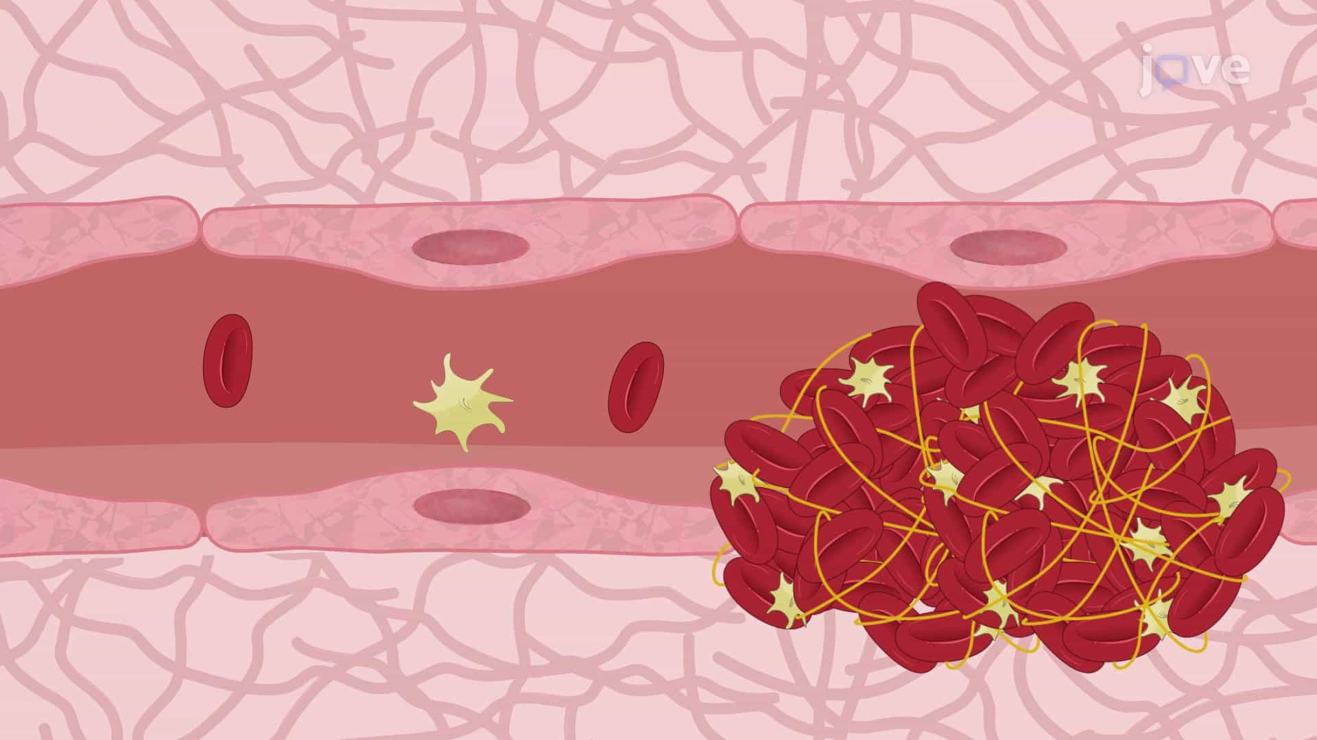 Intravital Fluorescence Microscopy to Study Microvascular Thrombus Formation