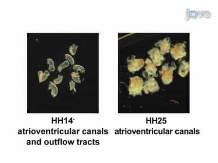 Isolation and Culture of Avian Embryonic Valvular Progenitor Cells