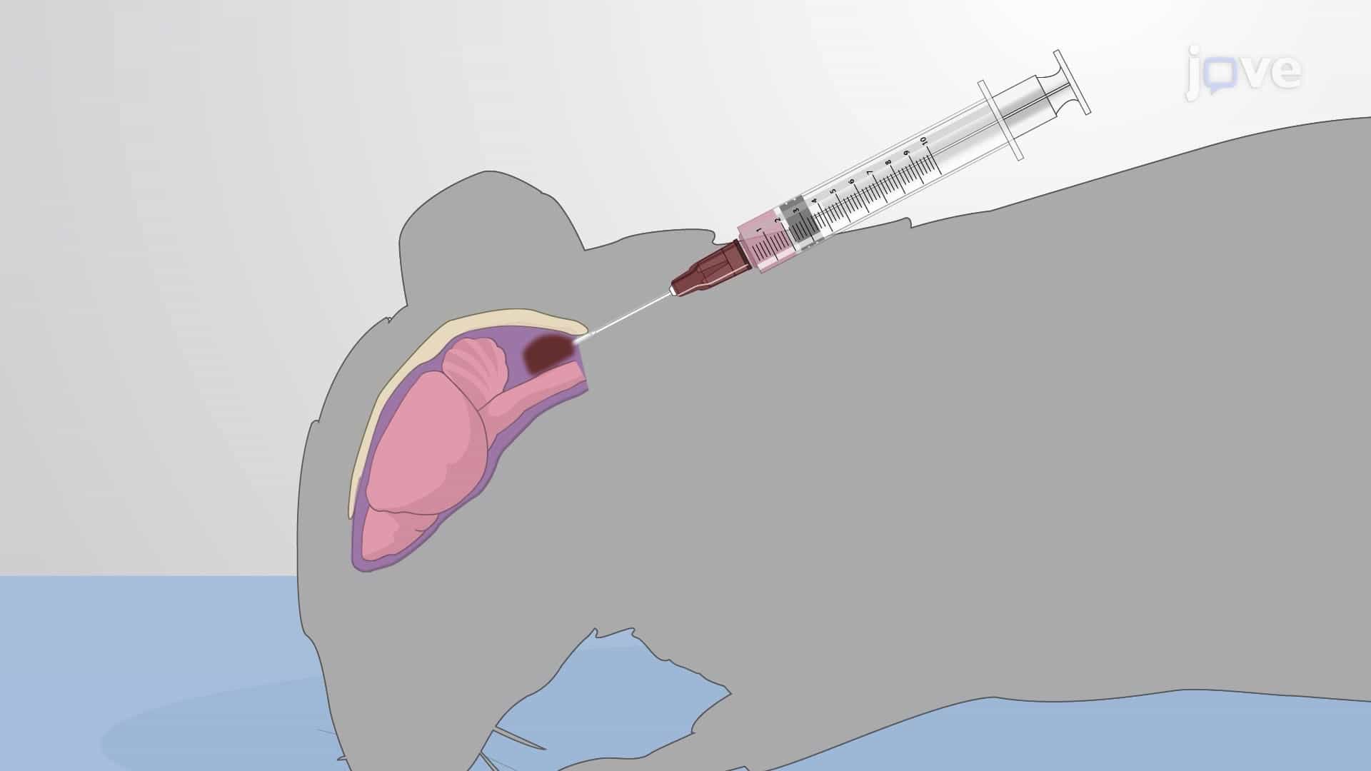 Intracisternal Delivery of Meningococci into Mouse Models to Induce Meningococcal Meningitis