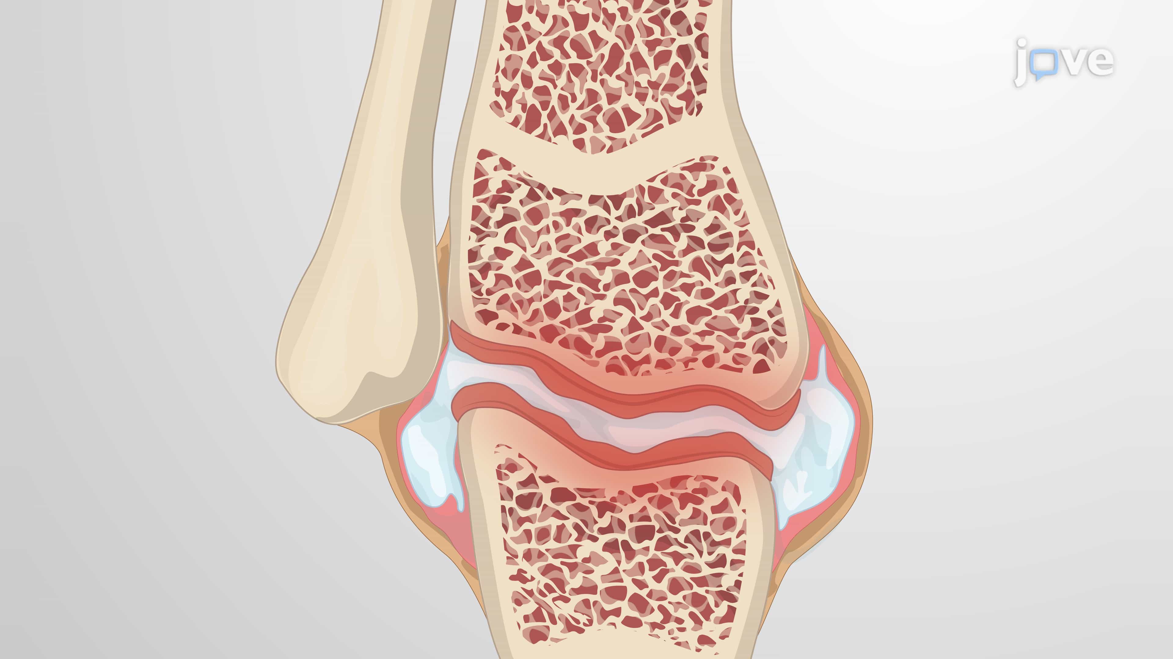 A Technique to Generate an Adjuvant-Induced Arthritis Mouse Model
