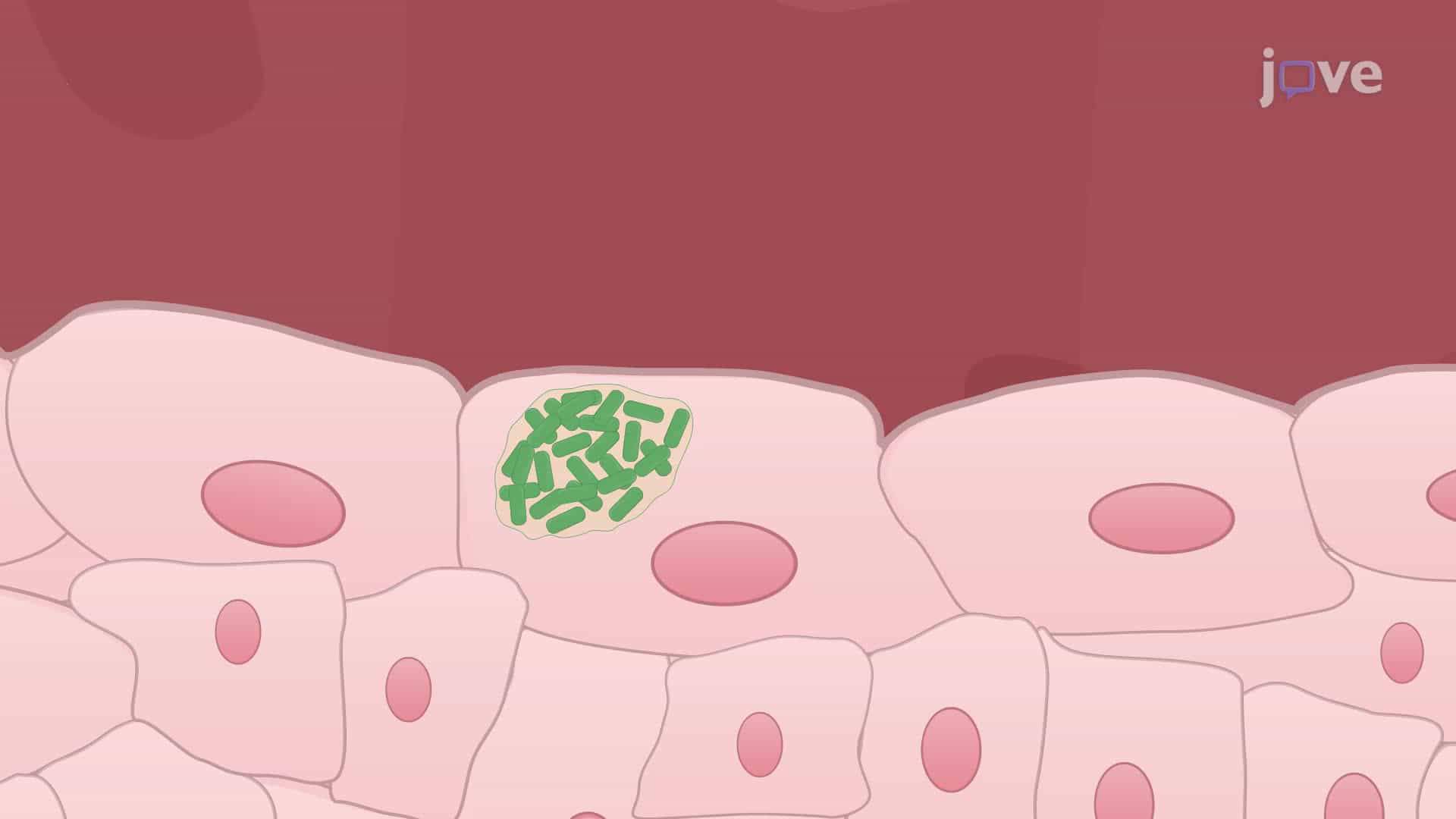 Transurethral Catheterization and Bacterial Inoculation to Generate a Urinary Tract Infection Model in Male Mice