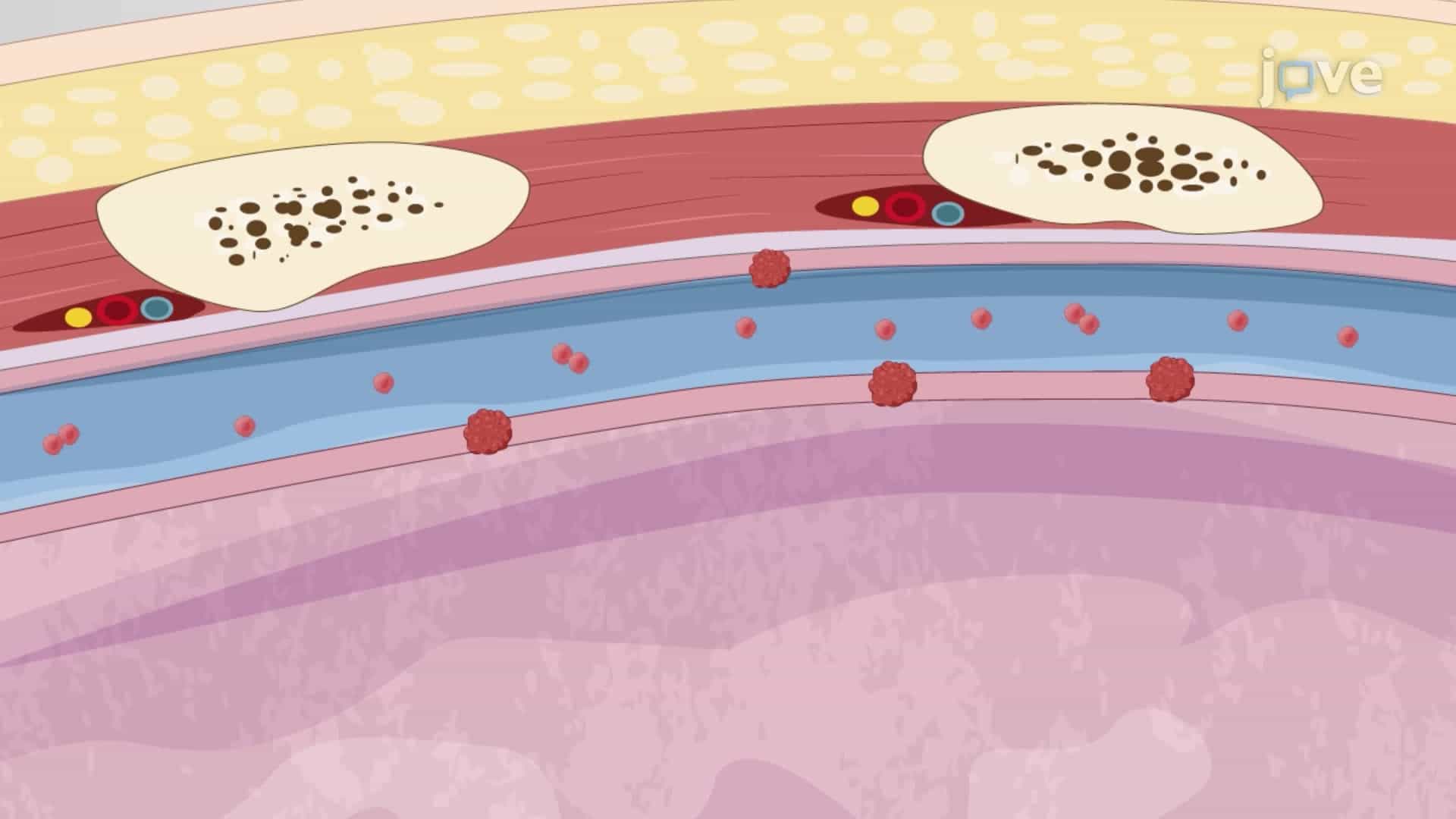 Establishing a Mouse Model of Pleural Disseminated Lung Cancer