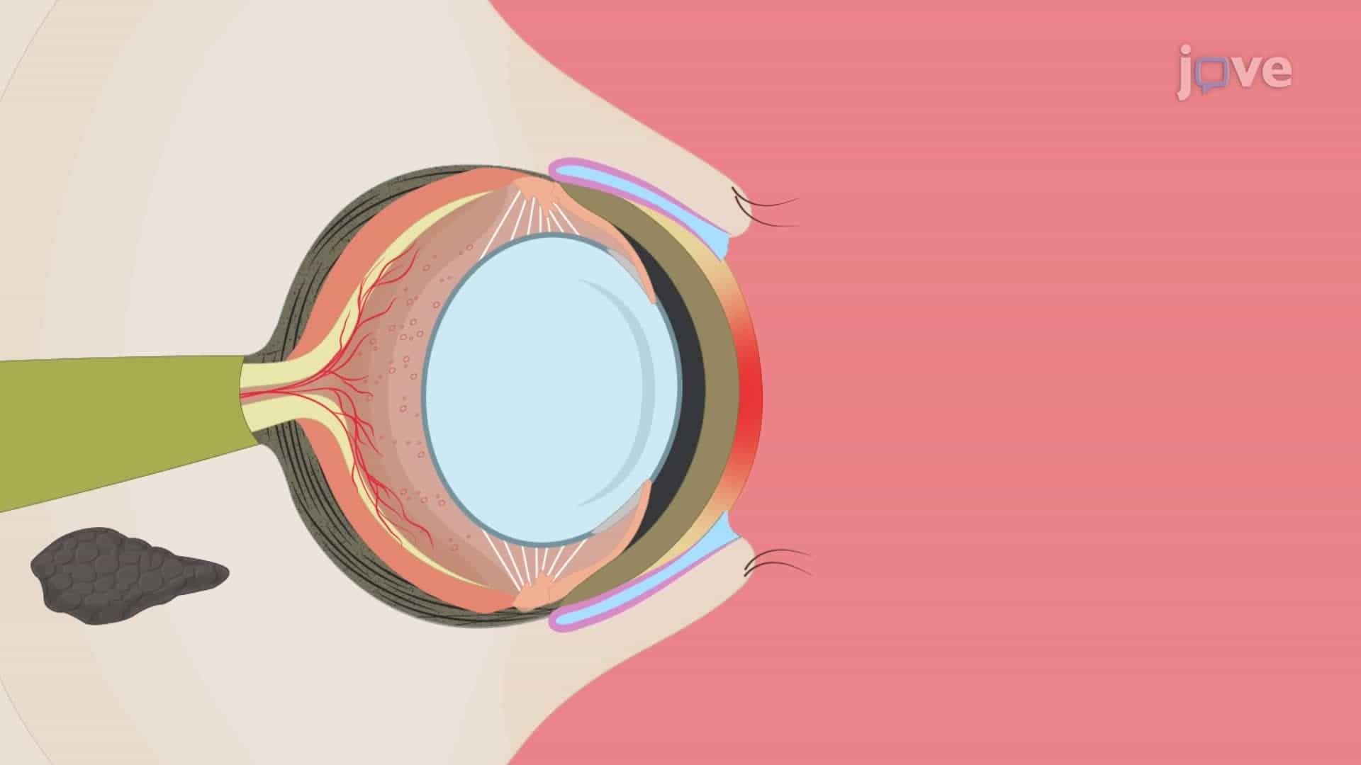 A Technique to Induce Chronic Experimental Autoimmune Dry Eye in Rats
