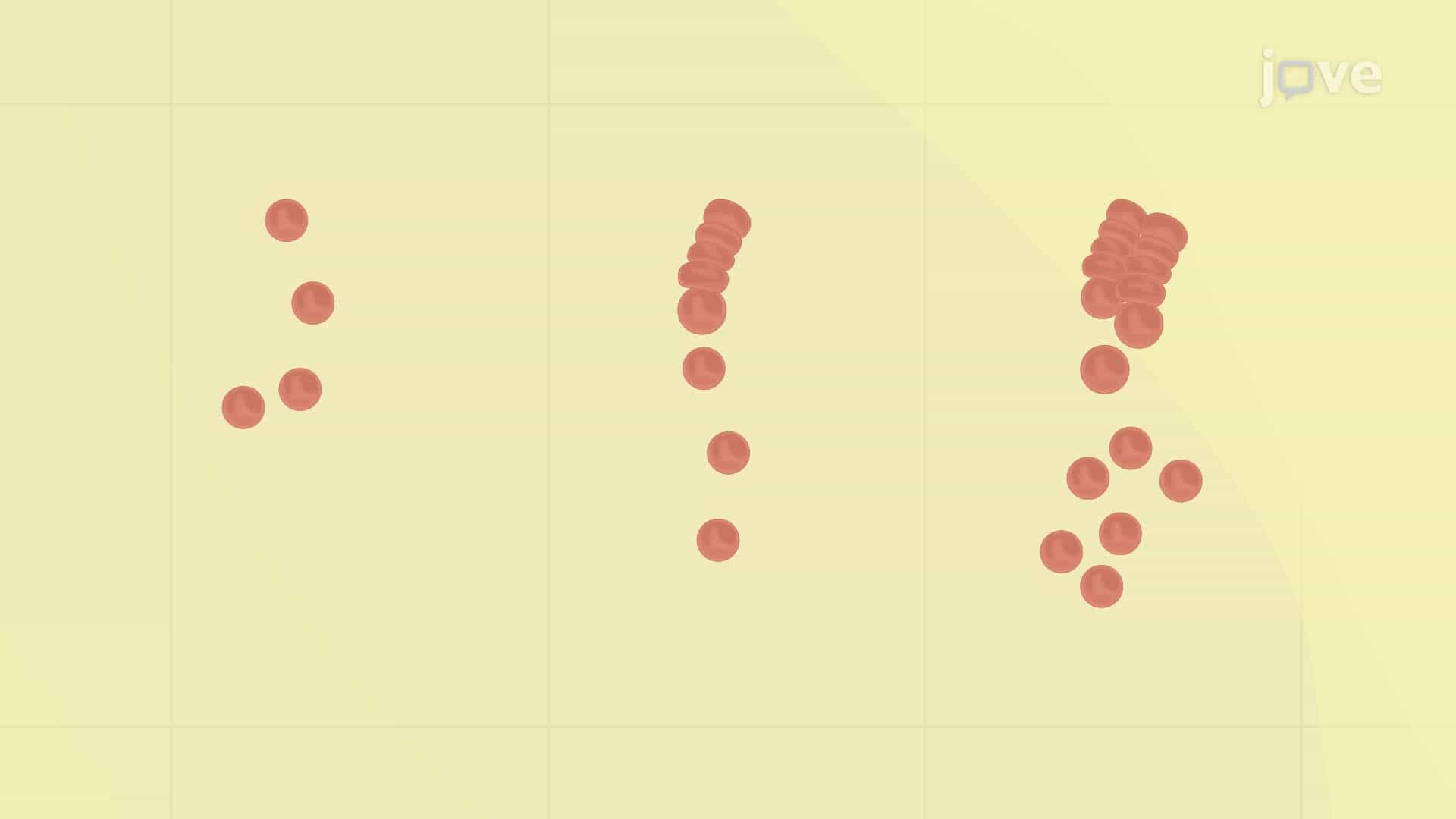 A Serum Bactericidal Assay for the Complement-Mediated Bactericidal Activity of Antibodies