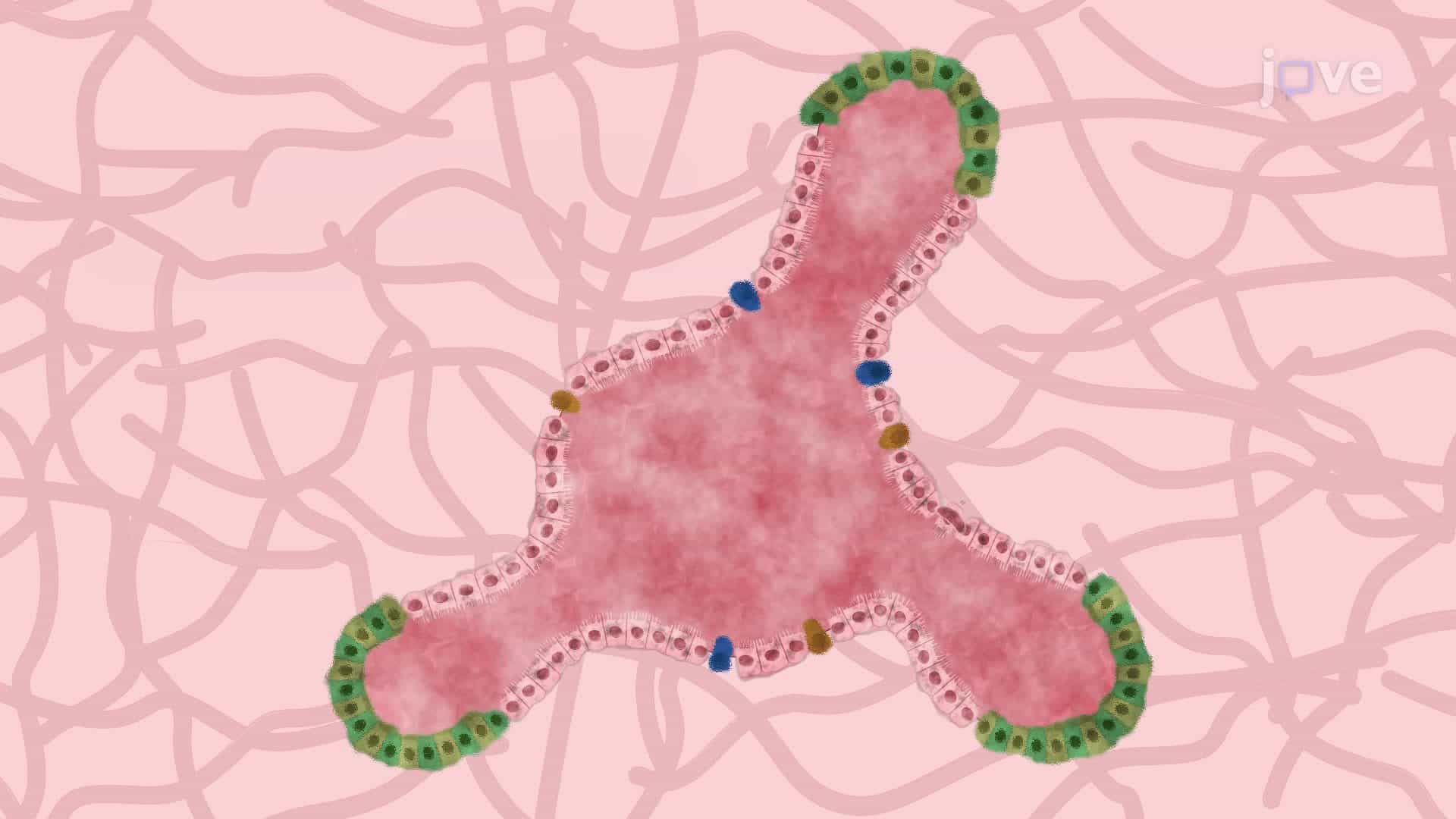 Induction of Necrotizing Enterocolitis in Human Epithelial Enteroid Model