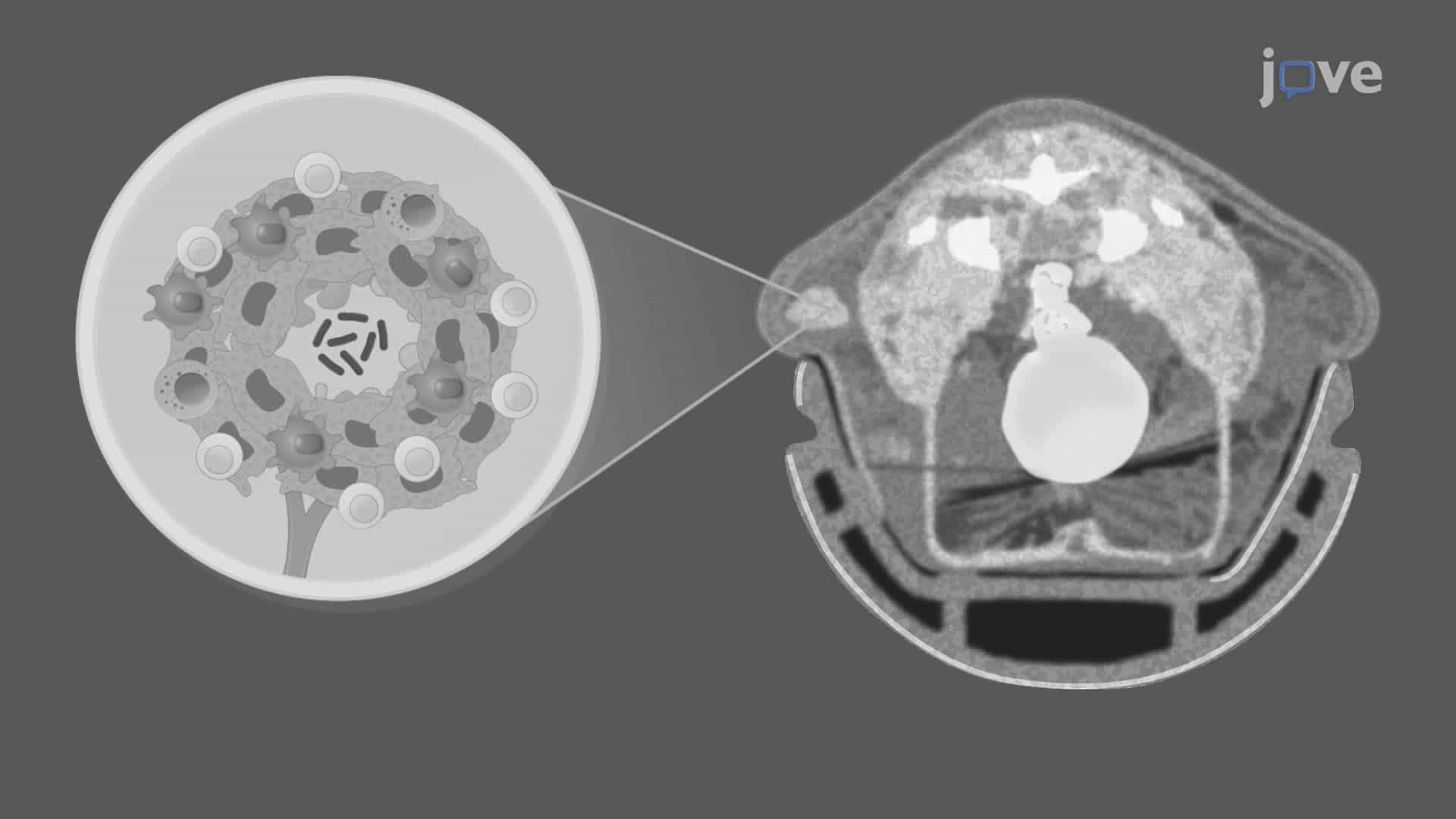 A Technique to Detect Extrapulmonary Tuberculosis via Superparamagnetic Nanoprobes