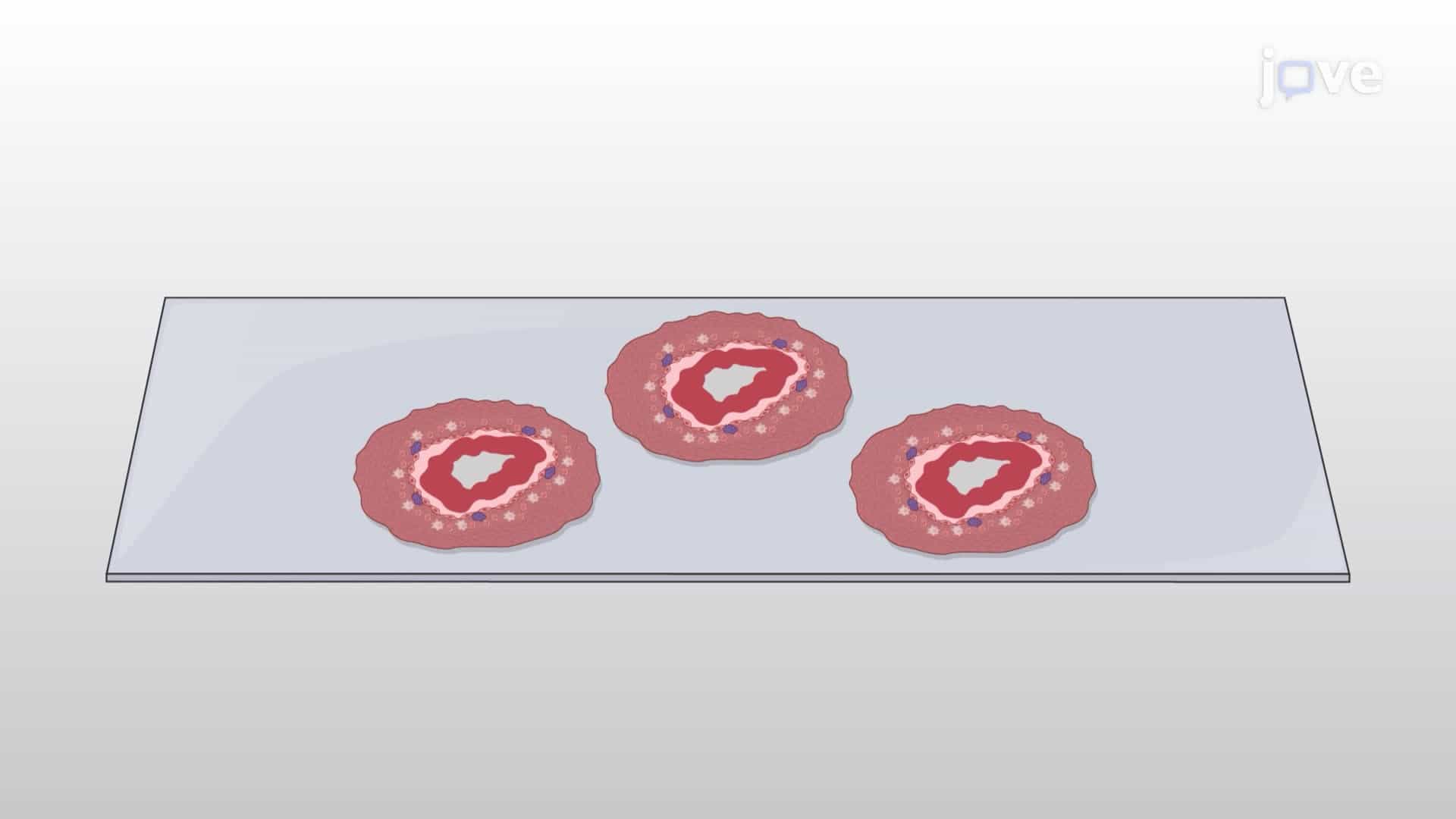 Immunohistochemistry to Study the Relationship Between Macrophages and Infiltrated Immune Cells