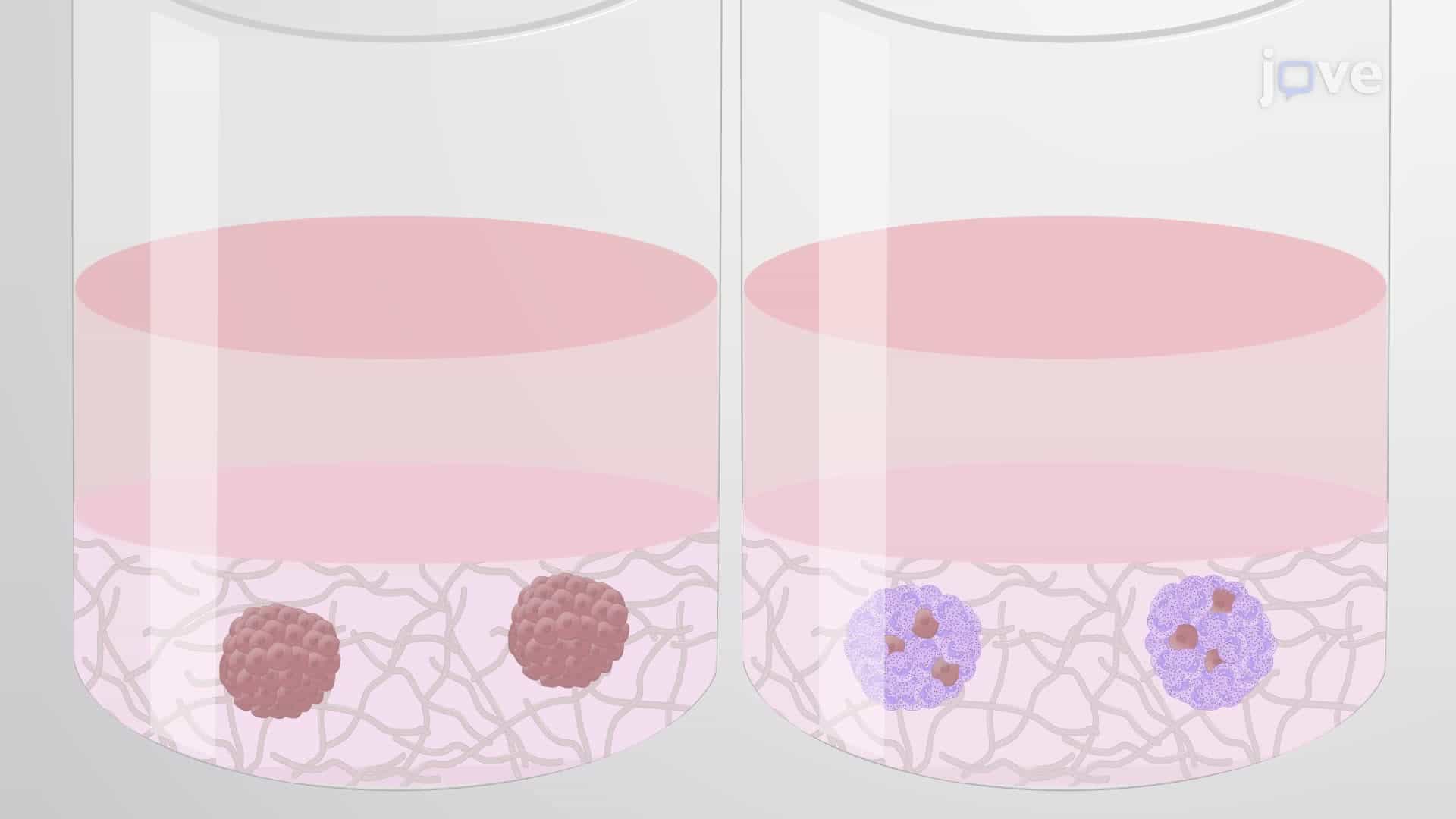 Determining the Role of Neutrophil-Like Cells in Lymphoma Cell Sensitivity to a Test Drug