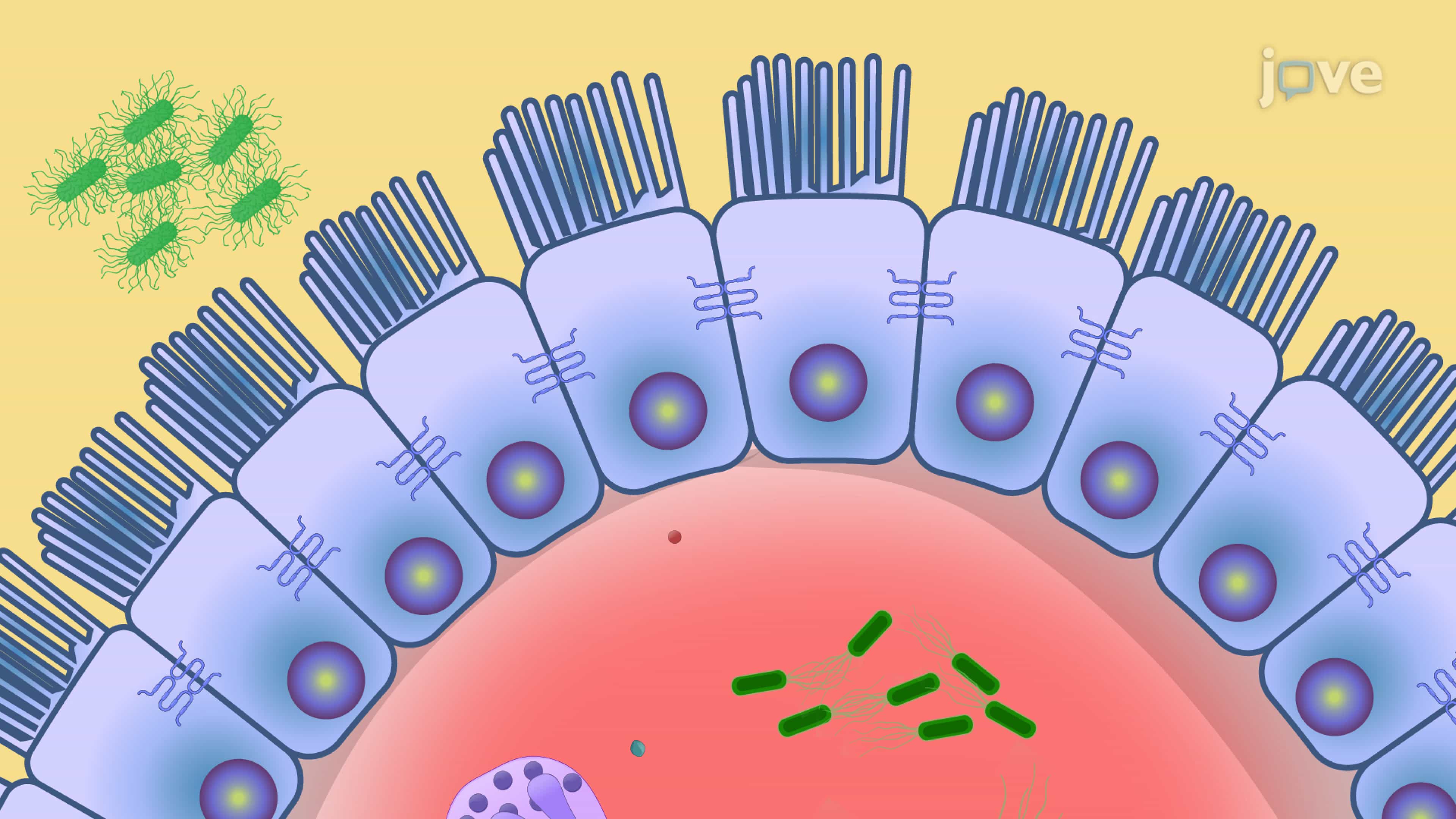 Evaluating the Effects of Fecal Microbiota Transplantation in an Interleukin-10 Deficient Mouse