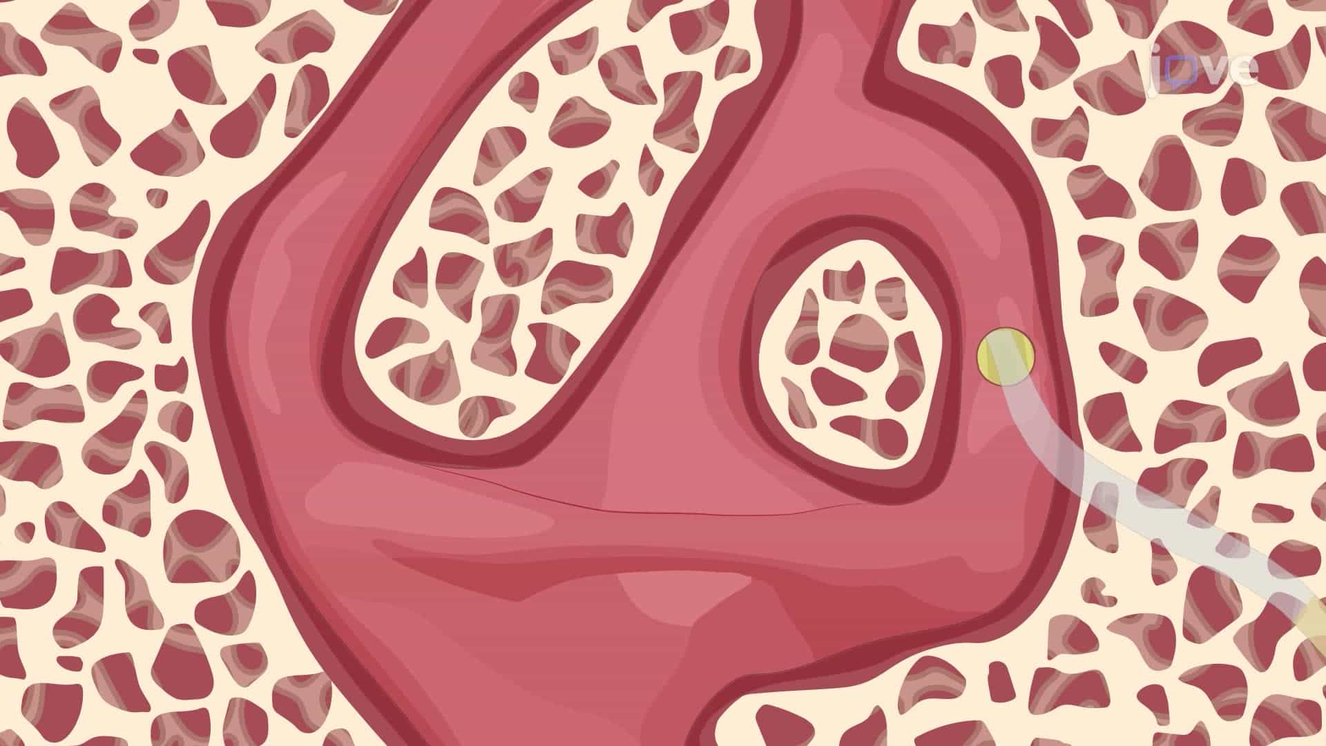 Canalostomy for Local Drug Delivery into the Inner Ear of an Adult Mouse