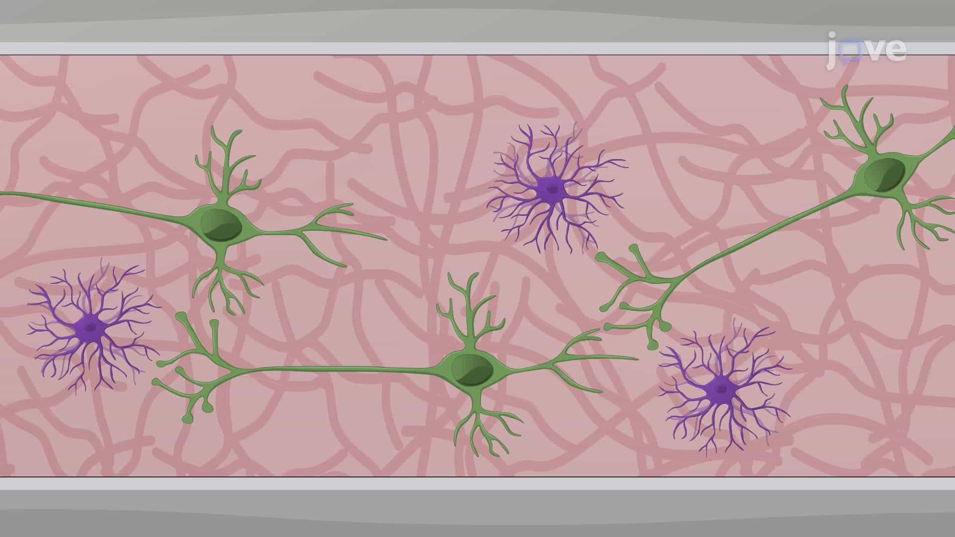 Co-culturing Glutamatergic Neurons and Pediatric High-Grade Glioma Cells