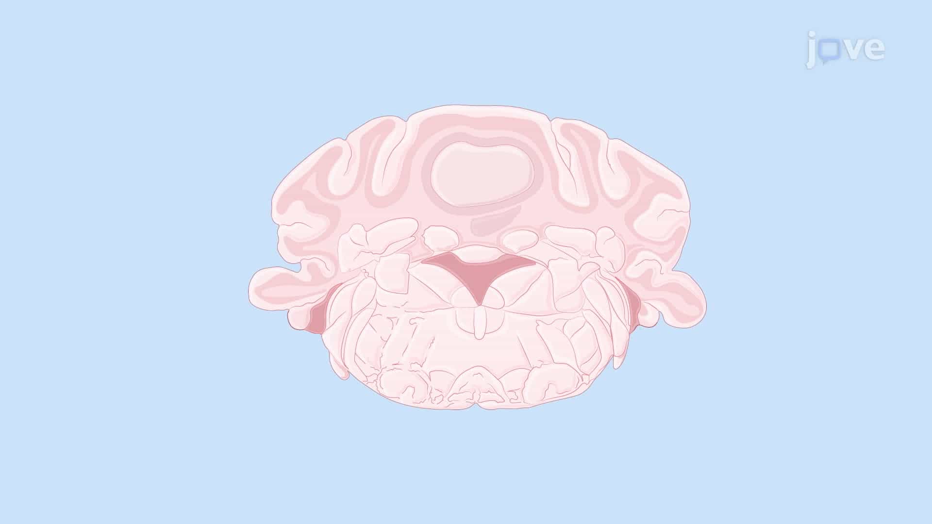 Applying Noise Currents to Medial Vestibular Nucleus Neurons Using Whole-Cell Patch-Clamp Technique