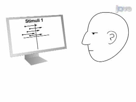 State-Dependency Effects on TMS: A Look at Motive Phosphene Behavior