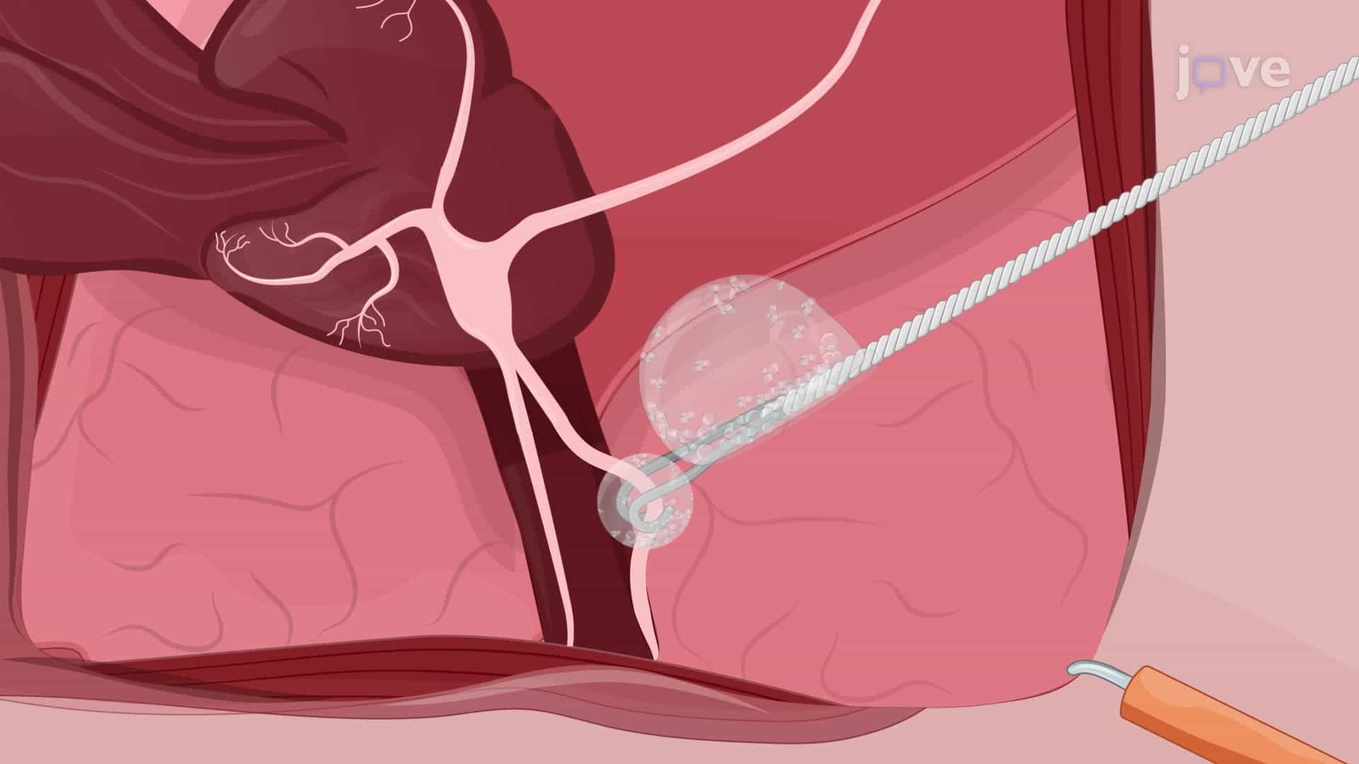 Performing Cavernous Nerve Stimulation in Rats to Measure Intracavernous Pressure