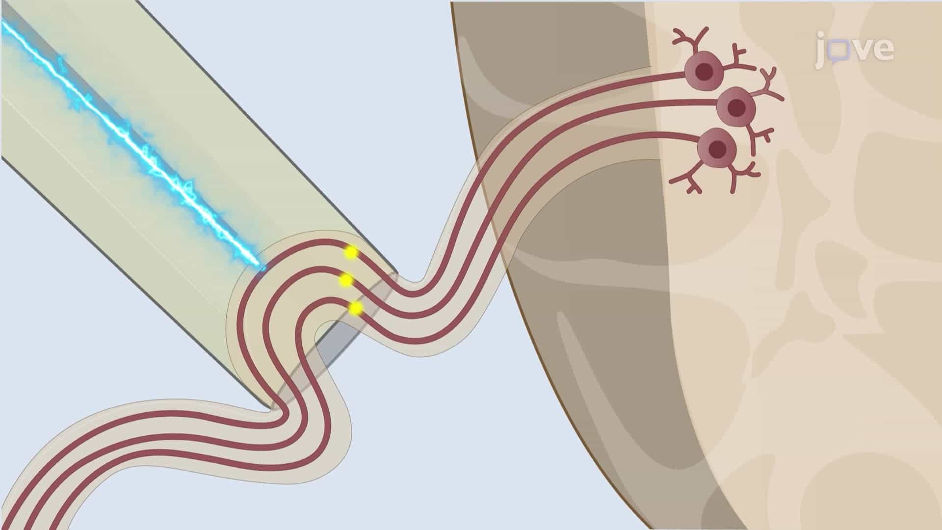 Extracellular Recording of Electrical Activity in the Drosophila Central Nervous System
