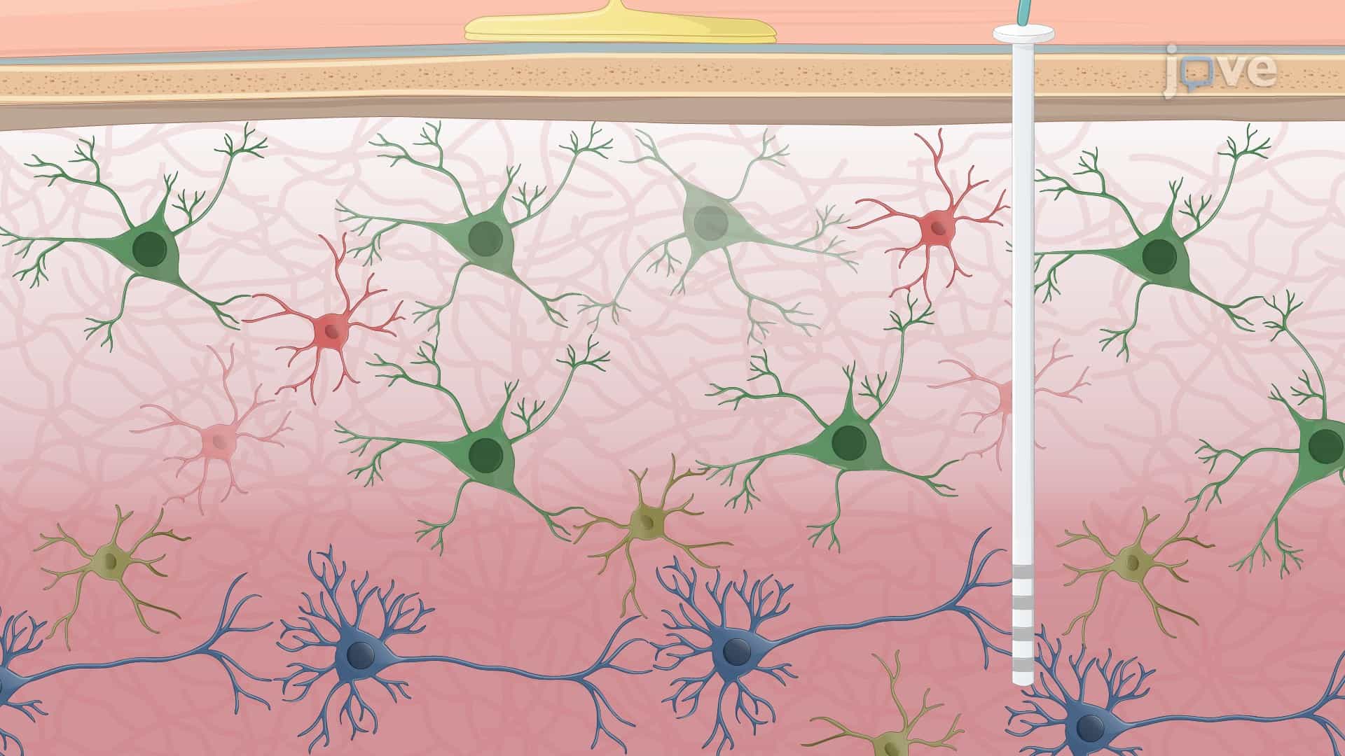 Recording Cortical and Subcortical Neuronal Activity Using Electrode Systems