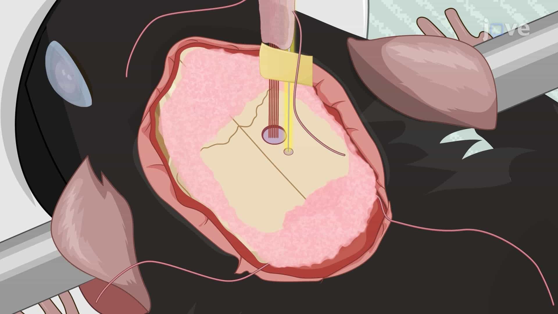 Implanting an Electrode Array and Optic Fiber into the Mouse Hippocampus