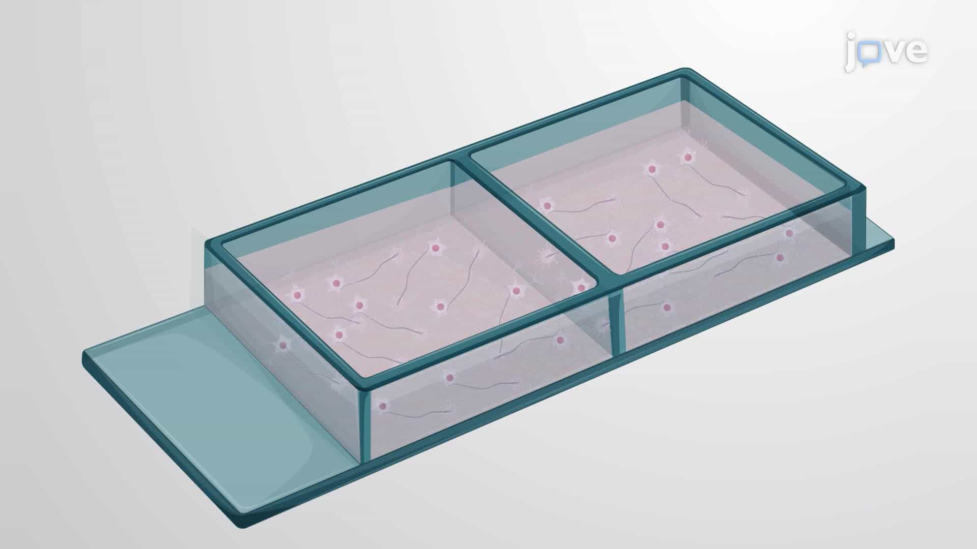 In Vitro Assessment of Aggregated Amyloid-β on Neuronal Growth Cone Collapse