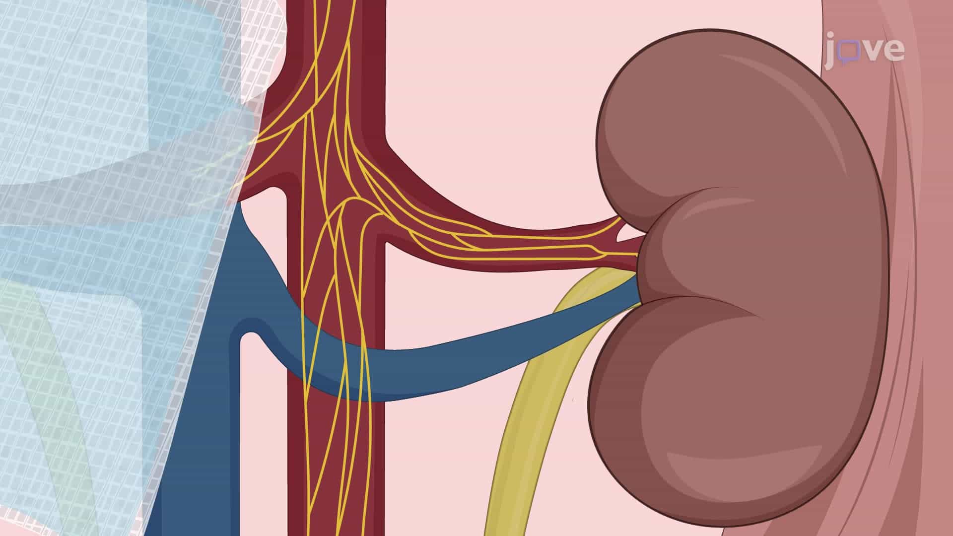 Sympathetic Denervation of Renal Arteries in an Angiotensin II-Induced Hypertension Mouse Model