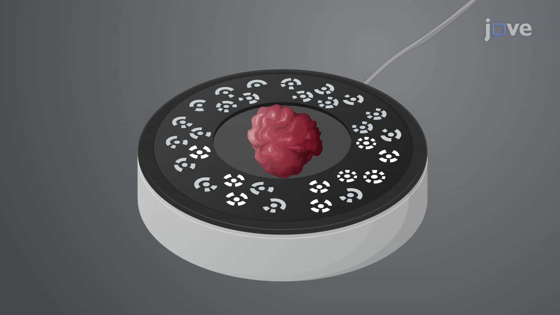Augmented Reality-Based Visualization of a Resected Tumor Specimen