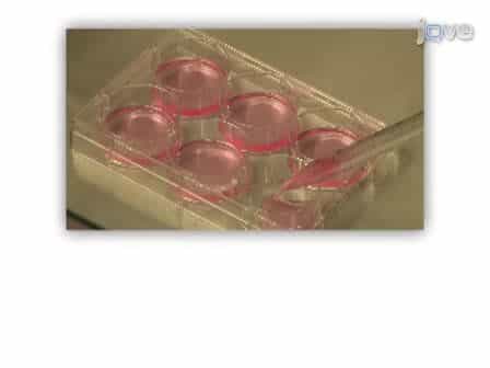 Ex vivo Expansion of Tumor-reactive T Cells by Means of Bryostatin 1/Ionomycin and the Common Gamma Chain Cytokines Formulation