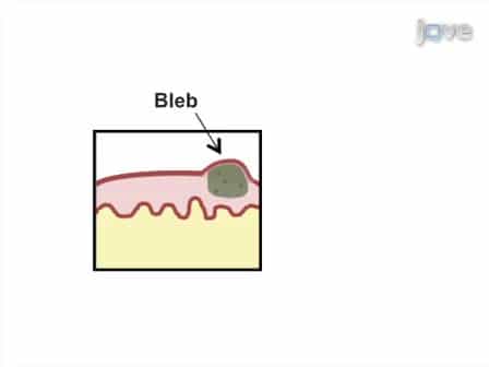 Mouse Bladder Wall Injection