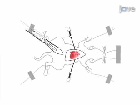 Use of a Hanging Weight System for Coronary Artery Occlusion in Mice