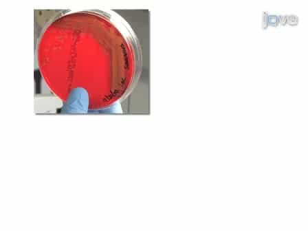 Subcutaneous Infection of Methicillin Resistant Staphylococcus Aureus MRSA