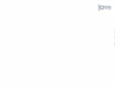 Fluorescence Recovery After Photobleaching FRAP of Fluorescence Tagged Proteins in Dendritic Spines of Cultured Hippocampal Neurons