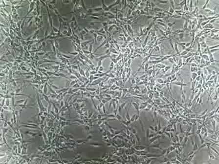 Passaging Human Neural Stem Cells