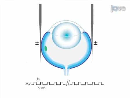 Transfection of Mouse Retinal Ganglion Cells by in vivo Electroporation