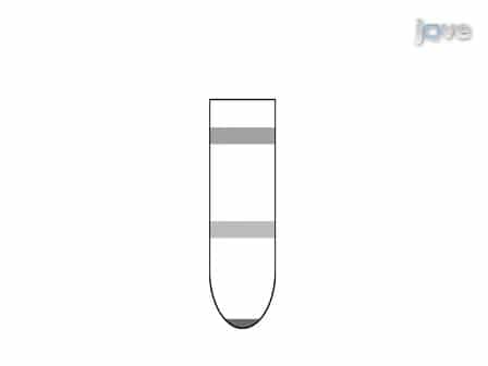 Isolation of Brain-infiltrating Leukocytes
