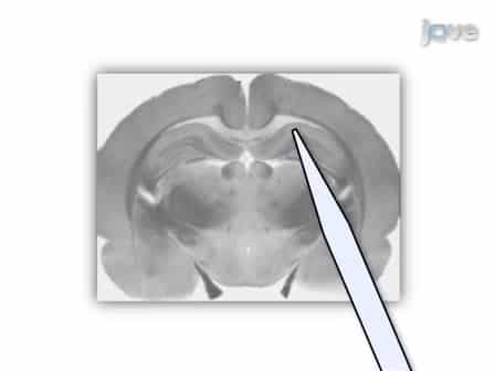 Vibrodissociation of Neurons from Rodent Brain Slices to Study Synaptic Transmission and Image Presynaptic Terminals