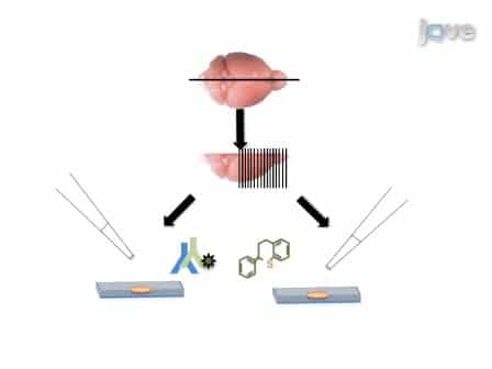 Detection of Neuritic Plaques in Alzheimer's Disease Mouse Model