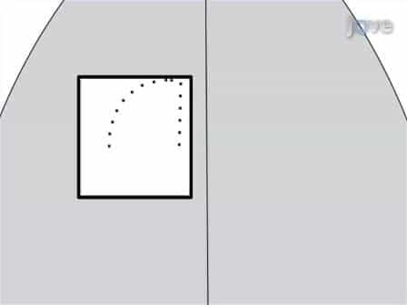 Preparing Undercut Model of Posttraumatic Epileptogenesis in Rodents