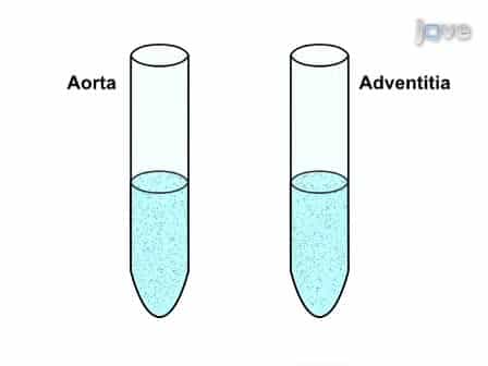 Flow Cytometry Analysis of Immune Cells Within Murine Aortas