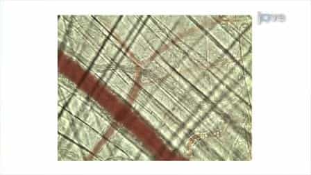 The Mouse Cremaster Muscle Preparation for Intravital Imaging of the Microcirculation