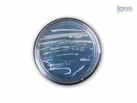 Agrobacterium-Mediated Virus-Induced Gene Silencing Assay In Cotton