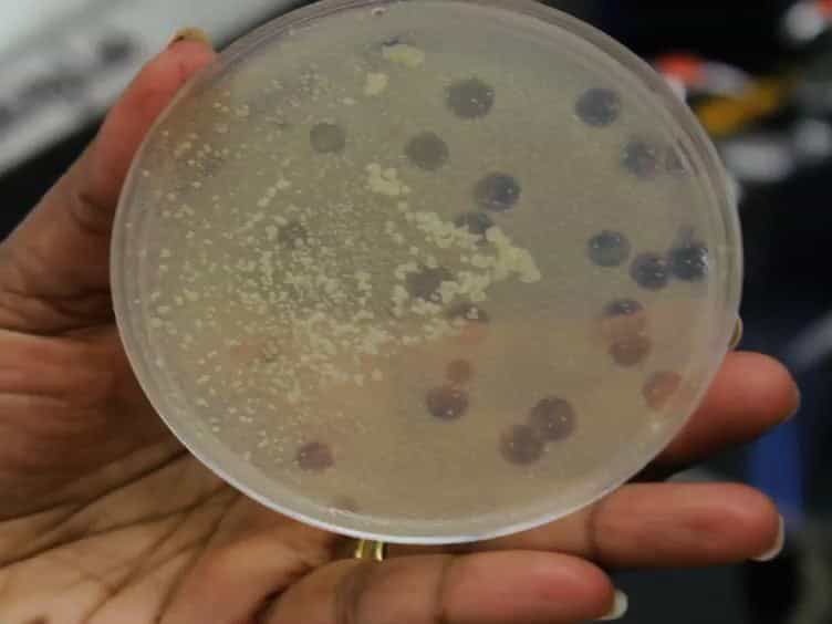 Aseptic Laboratory Techniques: Plating Methods