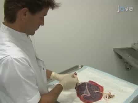 Accurate and Simple Evaluation of Vascular Anastomoses in Monochorionic Placenta using Colored Dye