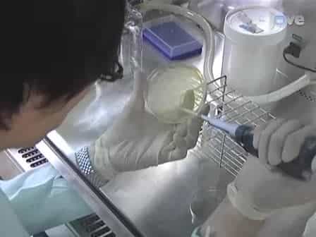 Application of a Mouse Ligated Peyer’s Patch Intestinal Loop Assay to Evaluate Bacterial Uptake by M cells