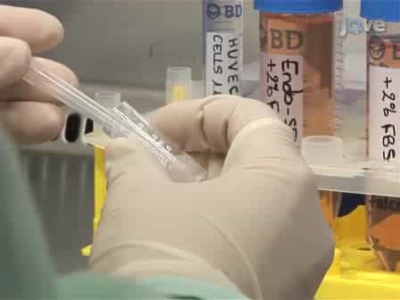 Introducing Shear Stress in the Study of Bacterial Adhesion