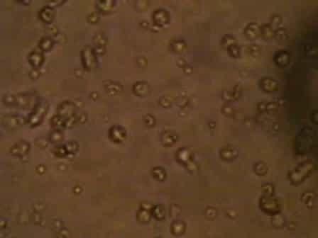 Induction and Monitoring of Adoptive Delayed-Type Hypersensitivity in Rats
