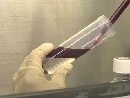 Enrichment of NK Cells from Human Blood with the RosetteSep Kit from StemCell Technologies