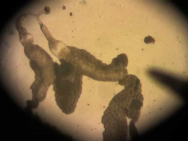 An Introduction to Parasitic Wasps of Drosophila and the Antiparasite Immune Response