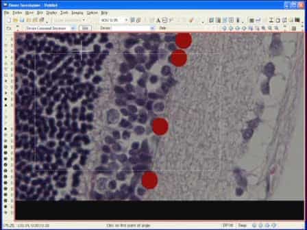 Morphometric Analyses of Retinal Sections