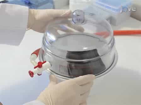MALDI Imaging Mass Spectrometry of Neuropeptides in Parkinson's Disease