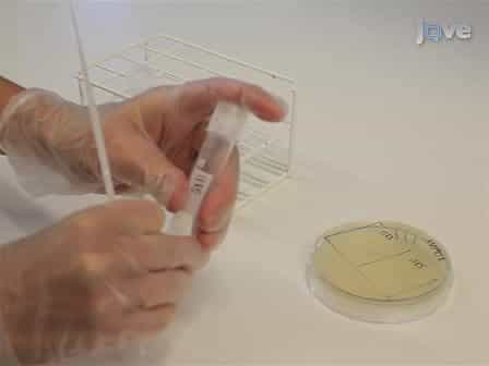 Quantitative Live Cell Fluorescence-microscopy Analysis of Fission Yeast