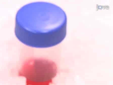 An Experimental System to Study Mechanotransduction in Fetal Lung Cells